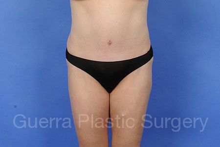 prev Case #29834 After