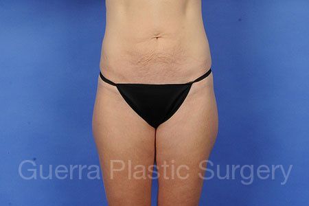 next Case #15879 Before
