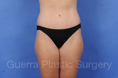 next Case #15879 After