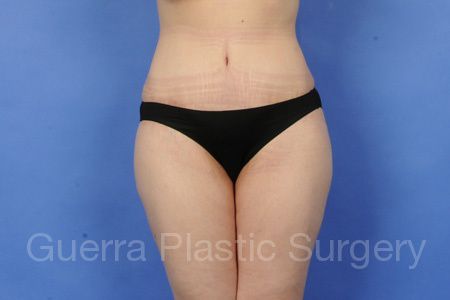 Case #11258 After