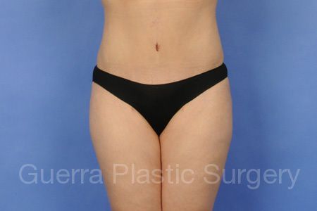 next Case #99689 After