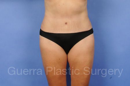 Case #11547 After
