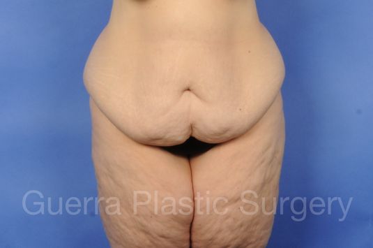 Case #01221 Before