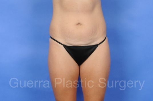 prev Case #01224 Before
