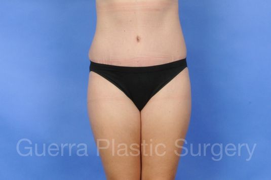 prev Case #01224 After