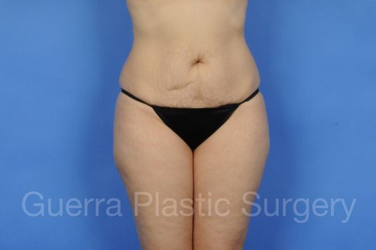 next Case #01225 Before