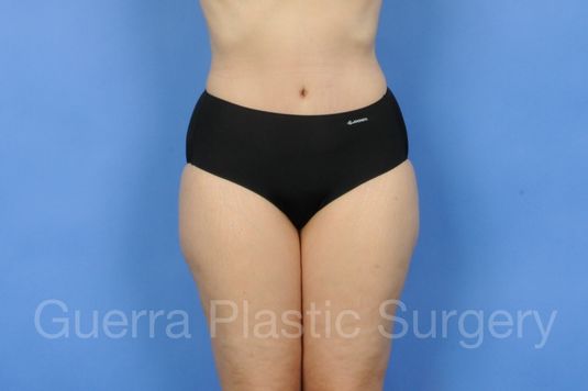 next Case #01225 After