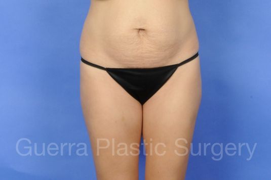 prev Case #01250 Before