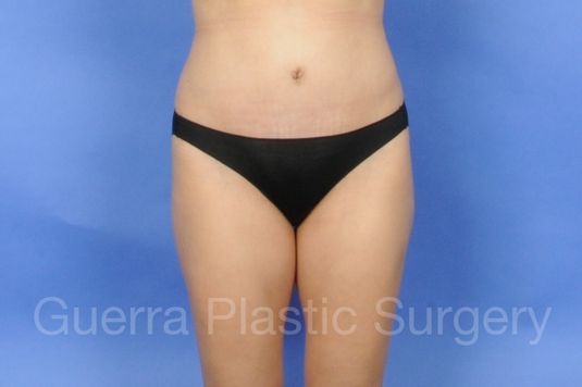prev Case #01250 After
