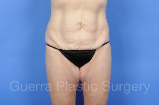 prev Case #01255 Before