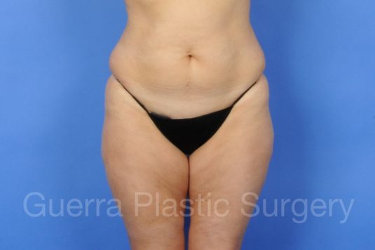 next Case #14719 Before