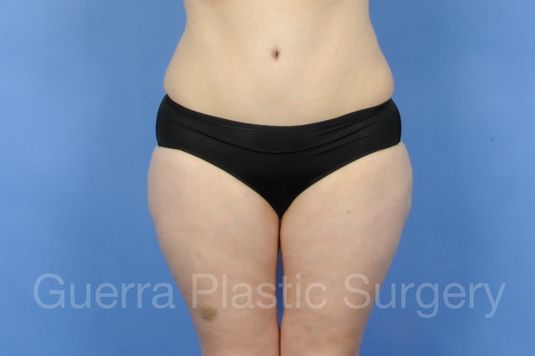 next Case #14719 After