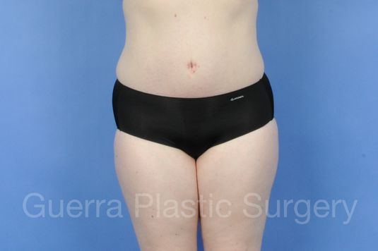 next Case #01285 After