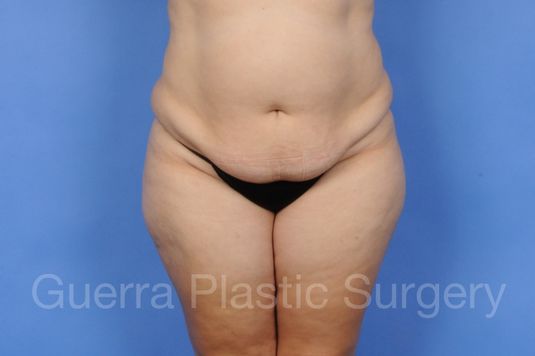 Case #01286 Before