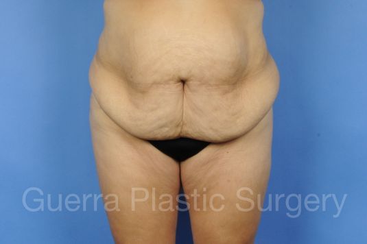 Case #01294 Before