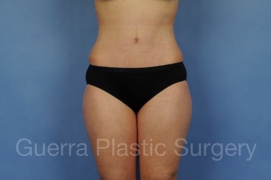 Case #01299 After