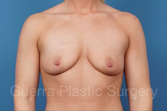 Case #34920 Before