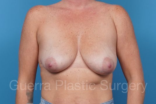 prev Case #40748 Before