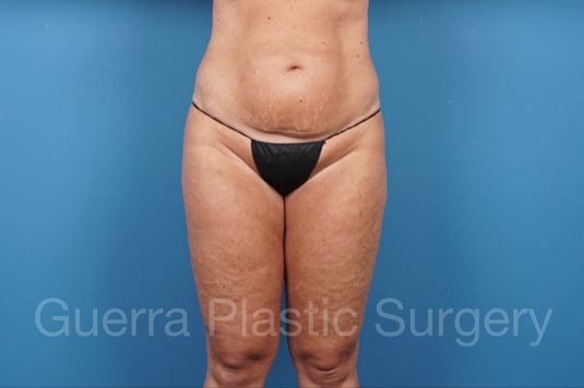 prev Case #32882 Before