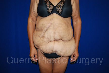 prev Case #32511 Before