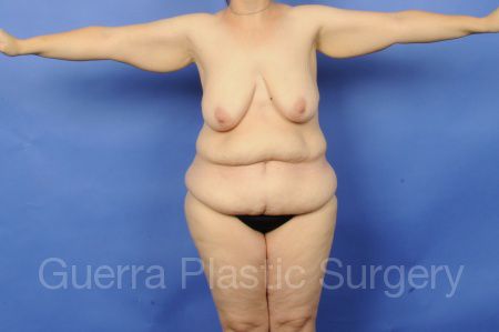 next Case #02023 Before