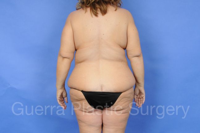 Before Photo 6