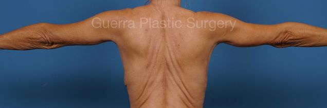 prev Case #34686 After