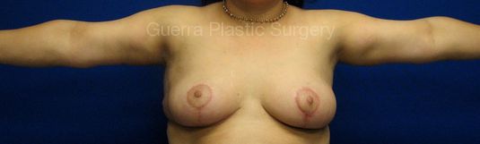 Case #10025 After