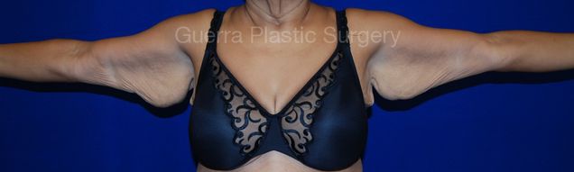 prev Case #16852 Before