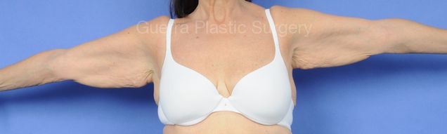 prev Case #30917 Before