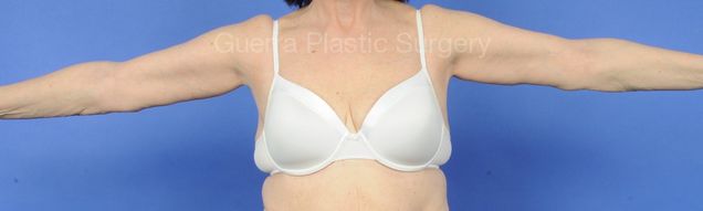 prev Case #30917 After
