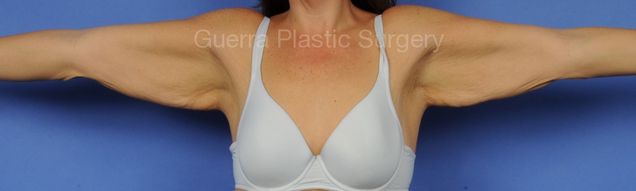 prev Case #17849 Before