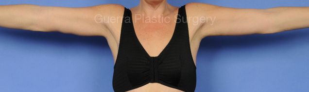 prev Case #17849 After