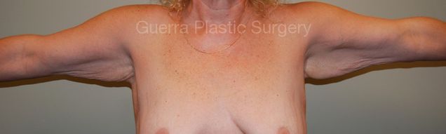 prev Case #12378 Before