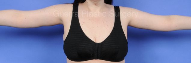 next Case #03022 After