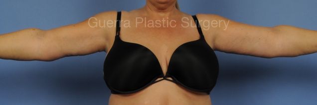 next Case #03029 After