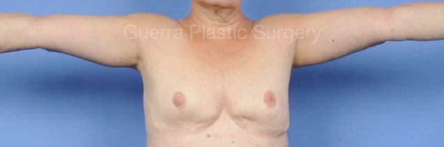next Case #03030 After