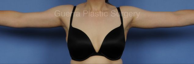 next Case #03032 After