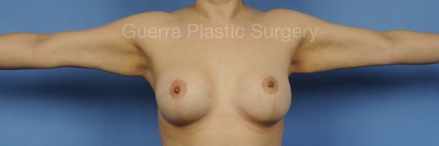 prev Case #03035 Before