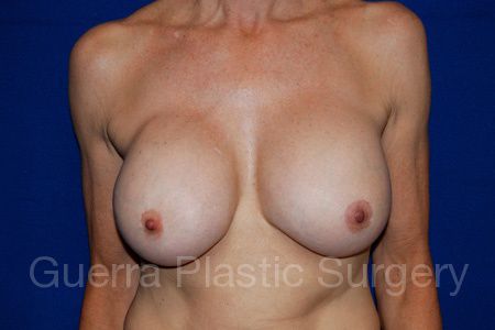 Case #29776 Before