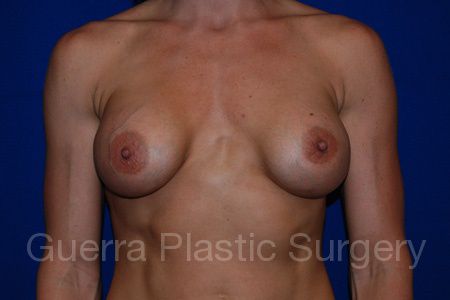 Case #30943 Before