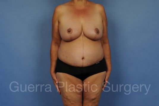 Case #28080 After
