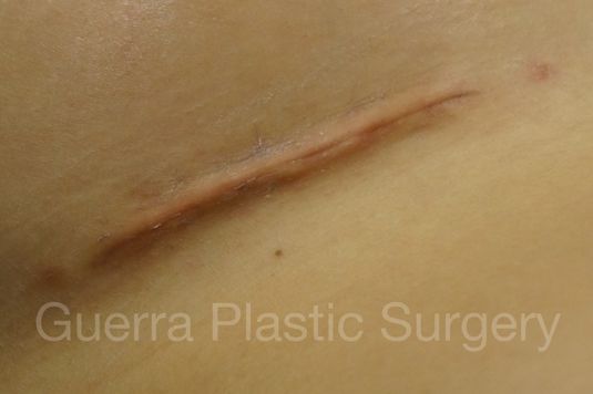 Case #4102 Before