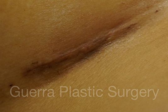 prev Case #4106 Before
