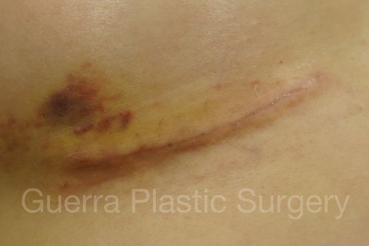 prev Case #4110 Before