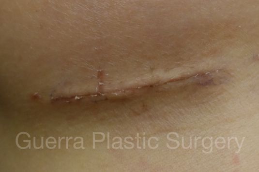 prev Case #4116 Before