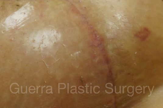prev Case #4001 Before