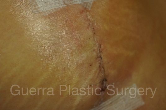 prev Case #0404 Before