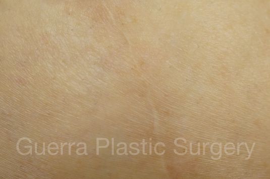 next Case #0405 After