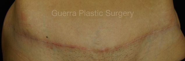 next Case #4201 After